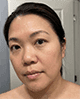 Verified Libida patient Dawn, age 44