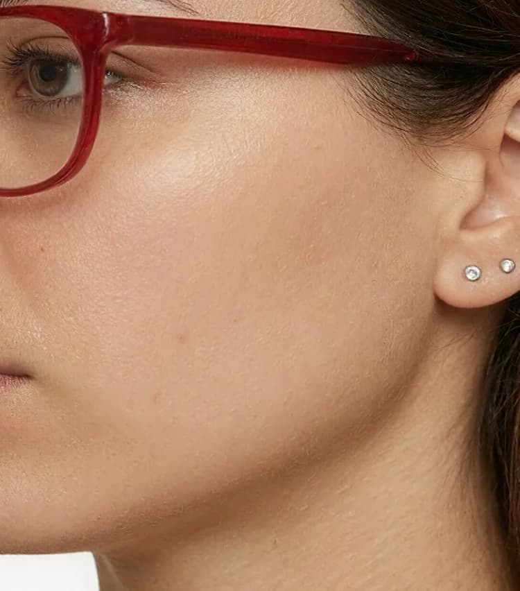 Judy, age 34 — BodyMatched before and after, reduced facial hair
