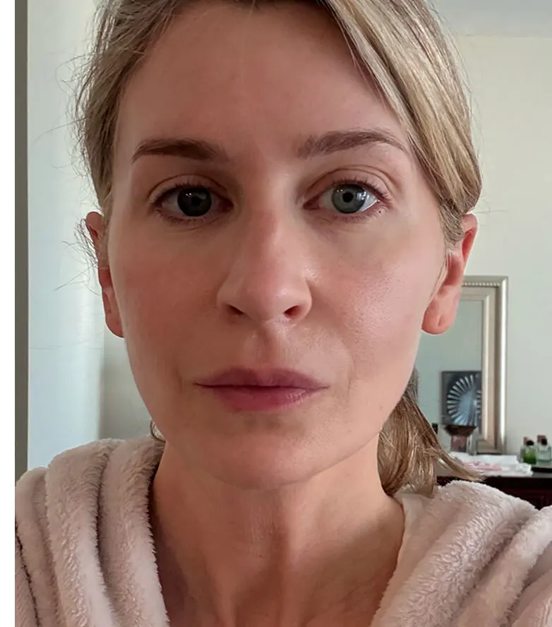 Stacey, age 37 — BodyMatched before and after, smoother and plumper skin