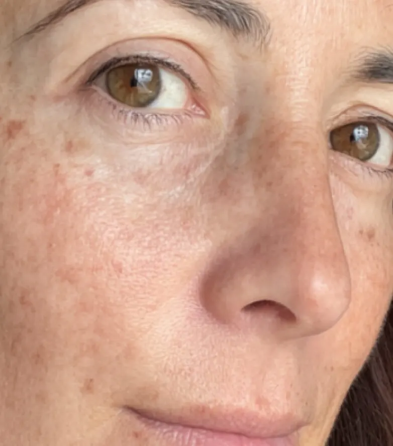 Kim, age 49 — BodyMatched before and after, brighter plumper skin