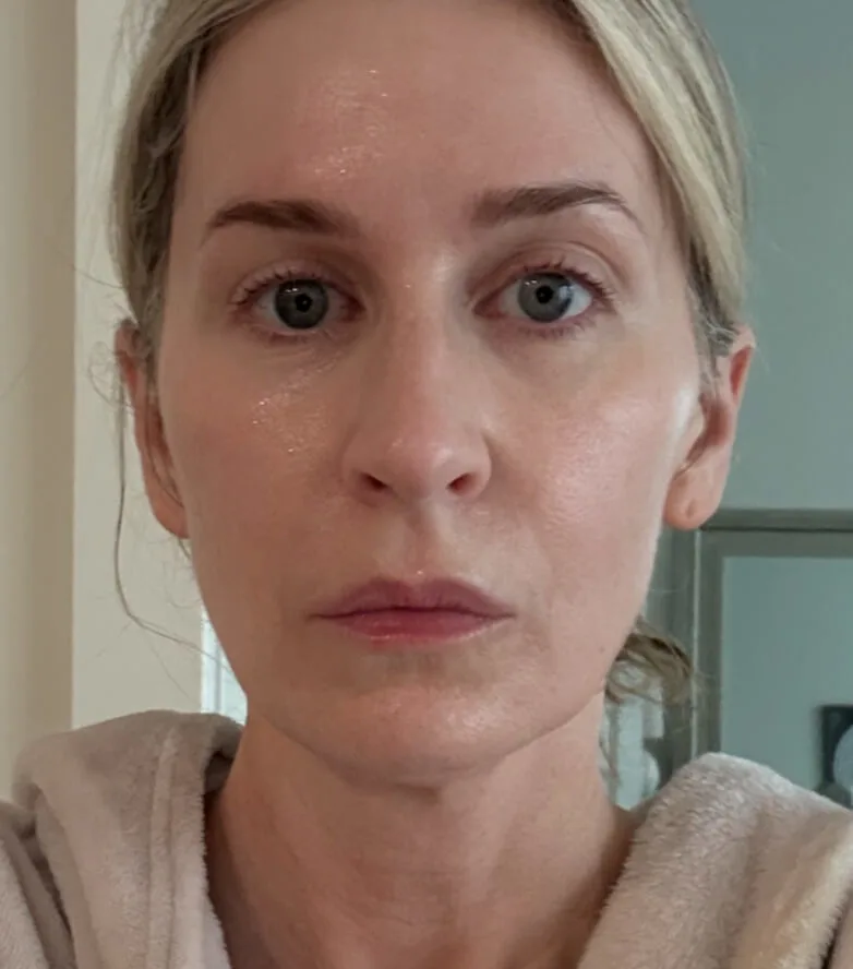 Stacey, age 37 — BodyMatched before and after, smoother and plumper skin