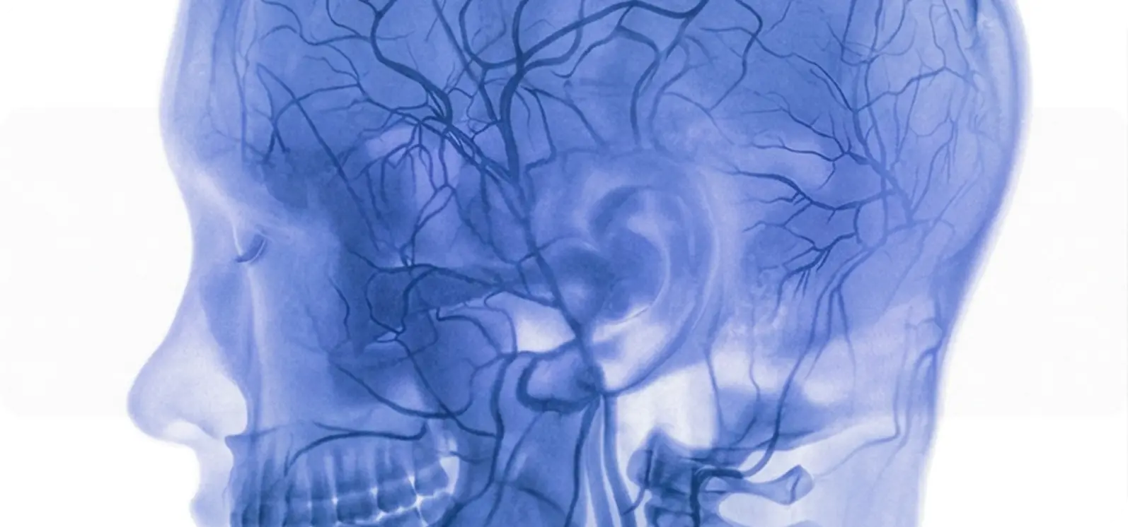 Brain scan visualization