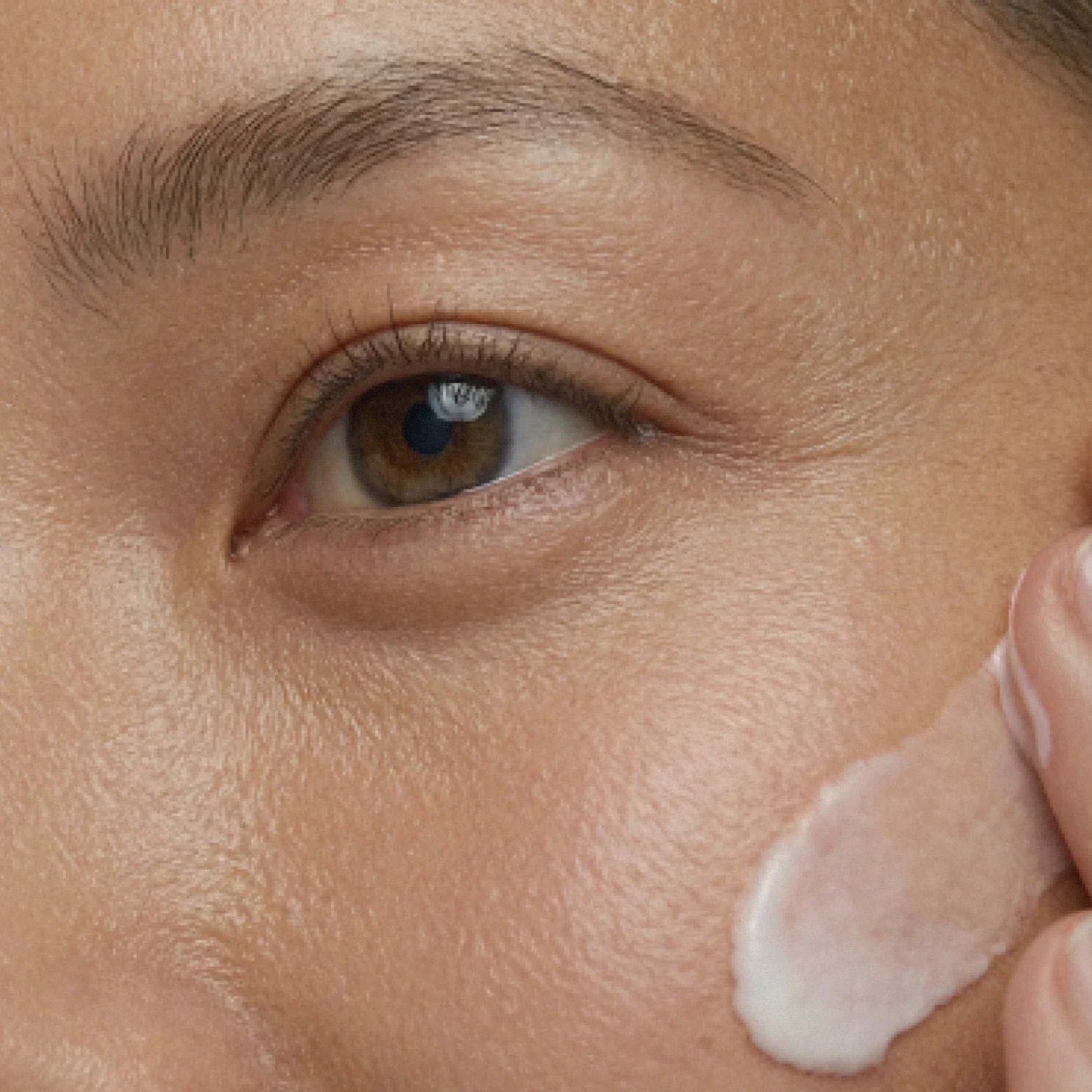 BodyMatched tretinoin cream with transdermal control applied to skin