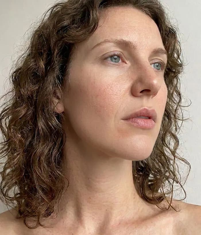 Rebecca — BodyMatched before and after, reduced wrinkles and smoother skin