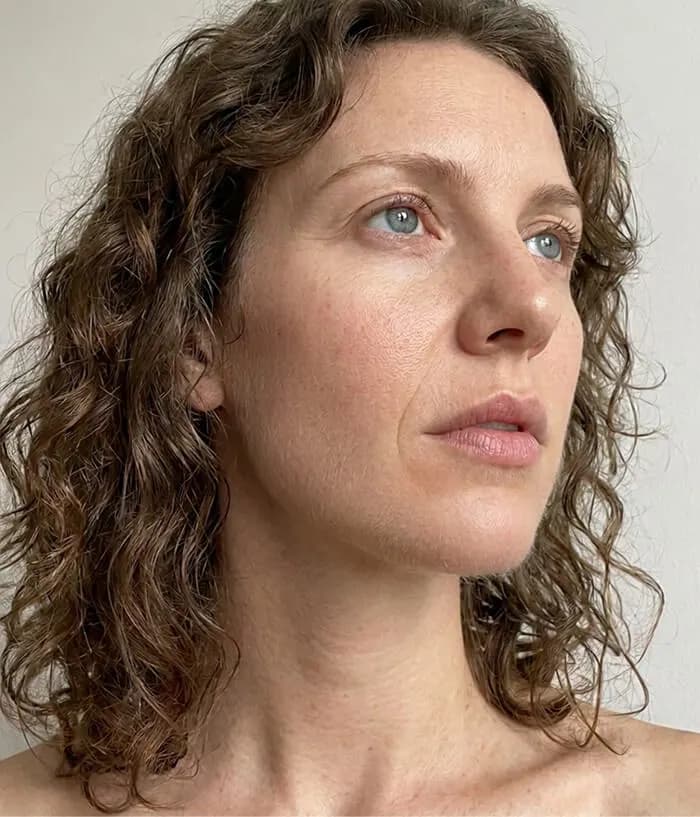 Rebecca — BodyMatched before and after, reduced wrinkles and smoother skin