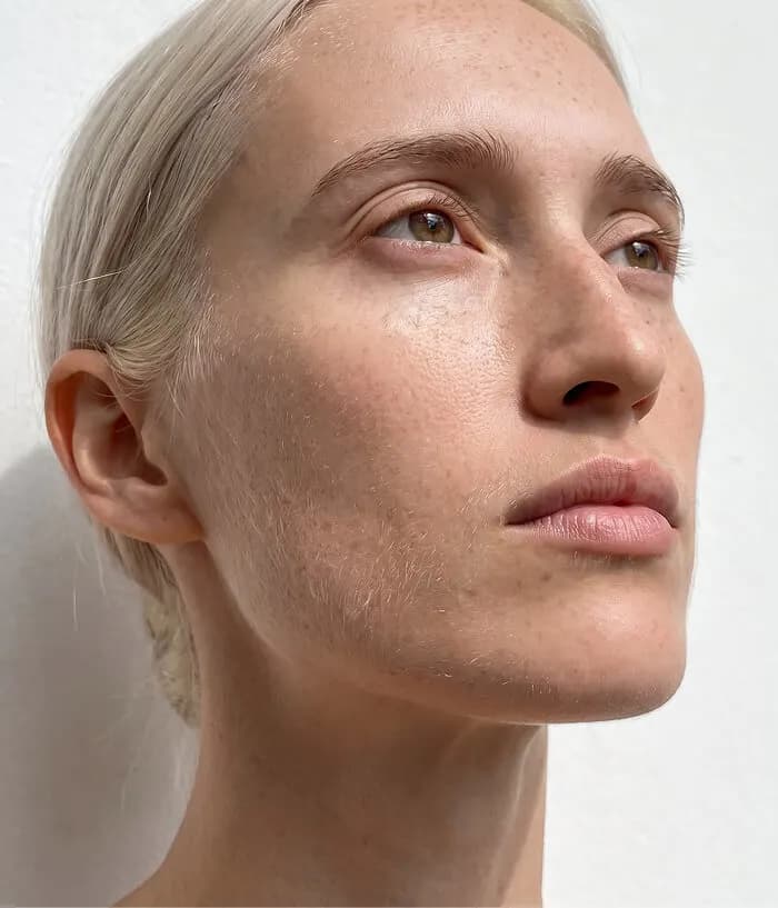 Kim, age 49 — BodyMatched before and after, brighter plumper skin
